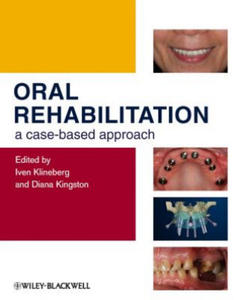 Oral Rehabilitation - A Case-Based Approach - 2867750464