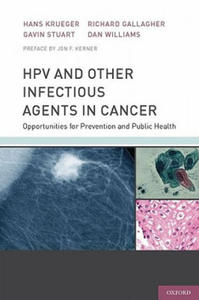 HPV and Other Infectious Agents in Cancer - 2862002060