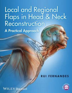 Local and Regional Flaps in Head & Neck Reconstruction - A Practical Approach - 2867759491