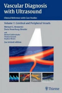 Vascular Diagnosis with Ultrasound - 2870128440