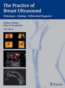 Practice of Breast Ultrasound - 2877955318