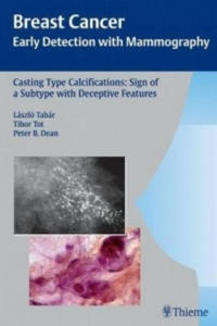 Casting-Type Calcifications: Sign of a Subtype with Deceptive Features - 2877757123