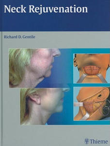 Neck Rejuvenation - 2878310228