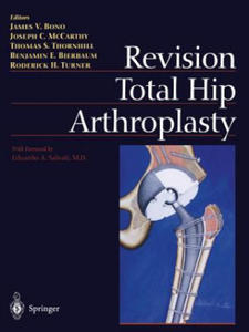 Revision Total Hip Arthroplasty - 2867163374