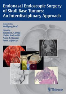 Endonasal Endoscopic Surgery of Skull Base Tumors: An Interdisciplinary Approach - 2874292389