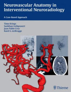 Neurovascular Anatomy in Interventional Neuroradiology - 2870043208