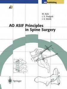 AO ASIF Principles in Spine Surgery - 2873172391