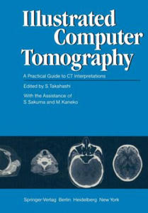 Illustrated Computer Tomography - 2876020961