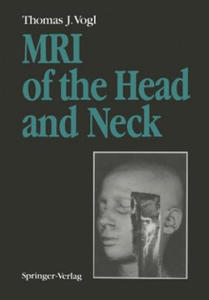 MRI of the Head and Neck - 2878082459