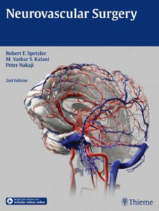 Neurovascular Surgery - 2873169088