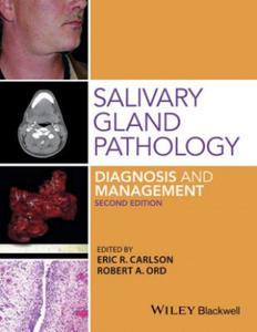 Salivary Gland Pathology - 2870215686