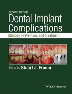 Dental Implant Complications - Etiology, , and Treatment, Second Edition - 2872204974