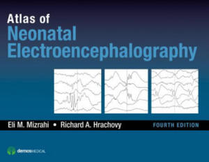 Atlas of Neonatal Electroencephalography - 2866527762