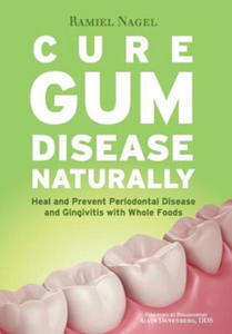 Cure Gum Disease Naturally - 2861902574