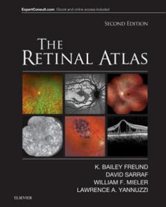 Retinal Atlas - 2863399633