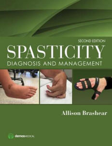 Spasticity - 2866531097