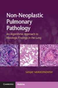Non-Neoplastic Pulmonary Pathology with Online Resource - 2867359598