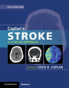 Caplan's Stroke - 2875135689