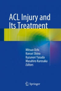 ACL Injury and Its Treatment - 2877626555