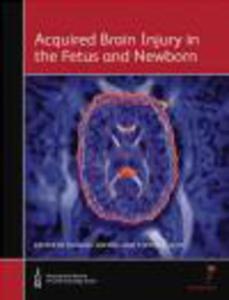 Acquired Brain Injury in the Fetus and Newborn - 2822222464