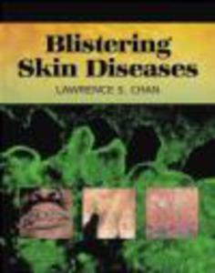 Blistering Skin Diseases - 2822222650