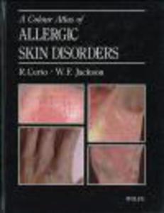 Color Atlas of Allergic Skin Disorders - 2822222770