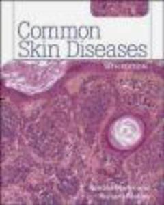 Common Skin Diseases - 2822222789