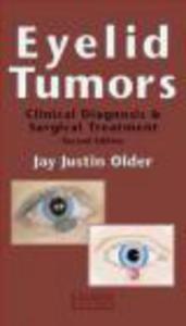 Eyelid Tumours - 2822223011