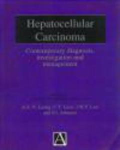 Hepatocellular Carcinoma - 2822223141