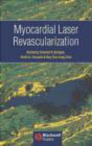 Myocardial Laser Revascularization - 2822223485