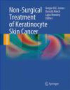 Non Surgical Treatment of Keratinocyte Skin Cancer - 2822223538