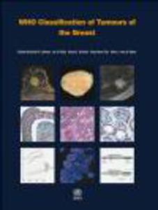 WHO Classification of Tumours of the Breast 4e - 2822223609