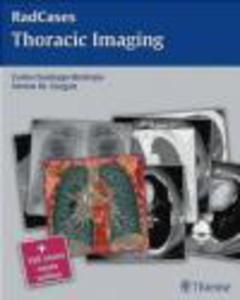Thoracic Imaging - 2822223678