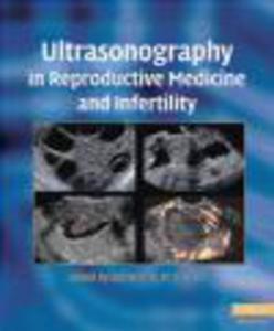 Ultrasonography in Reproductive Medicine and Infertility - 2822223730