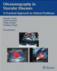 Ultrasonography in Vascular Diseases - 2822223732