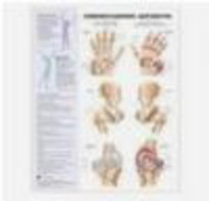 Understanding Arthritis Anatomical Chart - 2822223736