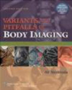 Variants and Pitfalls Body Imaging - 2822223756