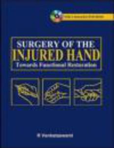 Surgery of the Injured Hand - 2822223835