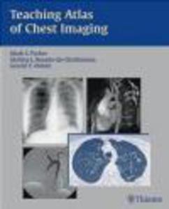 Teaching Atlas of Chest Imaging - 2822223854