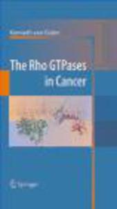 Rho GTPases in Cancer