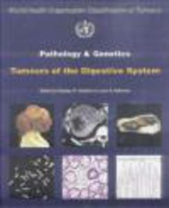 Pathology & Genetics of Tumours of Digestive System - 2822224009