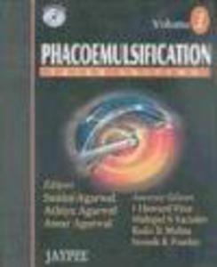 Phacoemulsification 2 vols - 2822224042