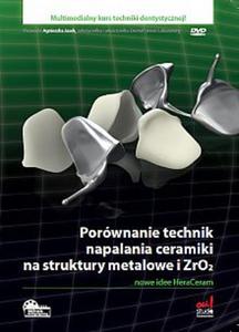 Porwnanie technik napalania ceramiki na struktury metalowe i ZrO2 - 2822224192