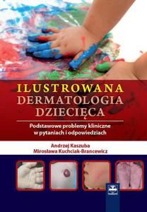 Ilustrowana dermatologia dziecica Podstawowe problemy kliniczne w pytaniach i odpowiedziach - 2822224303