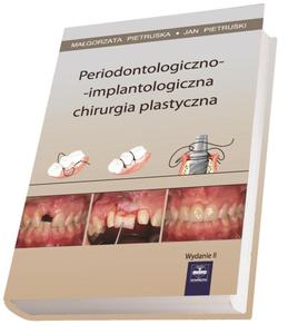 Periodontologiczno-implantologiczna chirurgia plastyczna - 2822224458