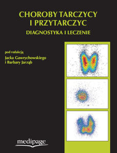 Choroby tarczycy i przytarczyc. Diagnostyka i leczenie - 2822224497