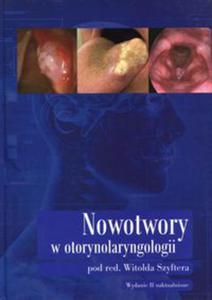 Nowotwory w otorynolaryngologii - 2848936585