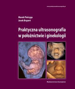 Praktyczna ultrasonografia w poonictwie i ginekologii- Promocja