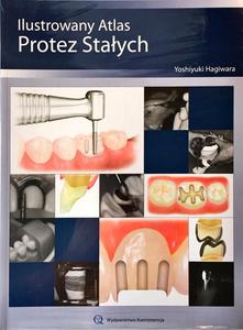 Ilustrowany atlas protez staych - 2848937032
