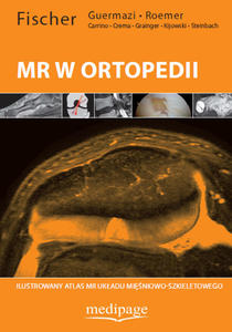 ATLAS DIAGNOSTYKI MR W ORTOPEDII. W. FISCHER